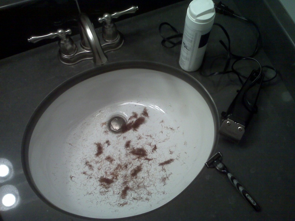 Gross hairy sink